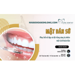 Phục hồi vẻ đẹp và độ trắng sáng tự nhiên một cách hoàn hảo bằng mặt dán sứ